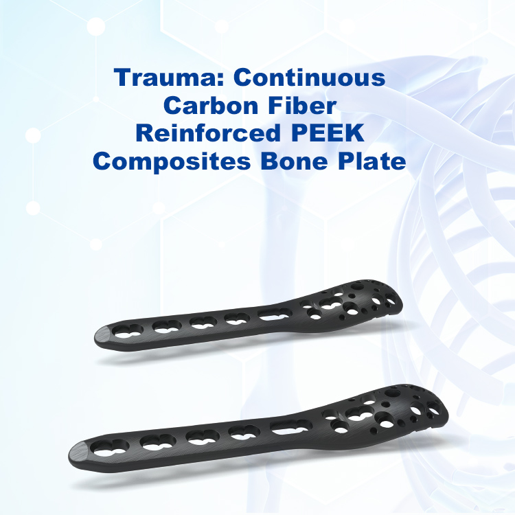 Trauma: Continuous Carbon Fiber Reinforced PEEK Composites Bone Plate